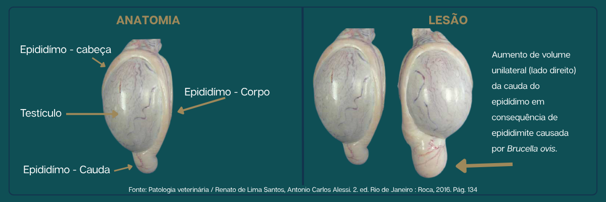 Figura 1 — Anatomia do epidídimo e lesão causada por Brucella ovis